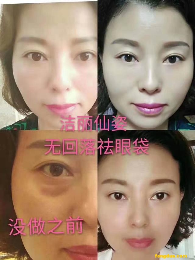 ��ô����������Ż�������һ�����᣿